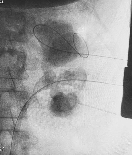 Visita urologica per le malattie urologiche