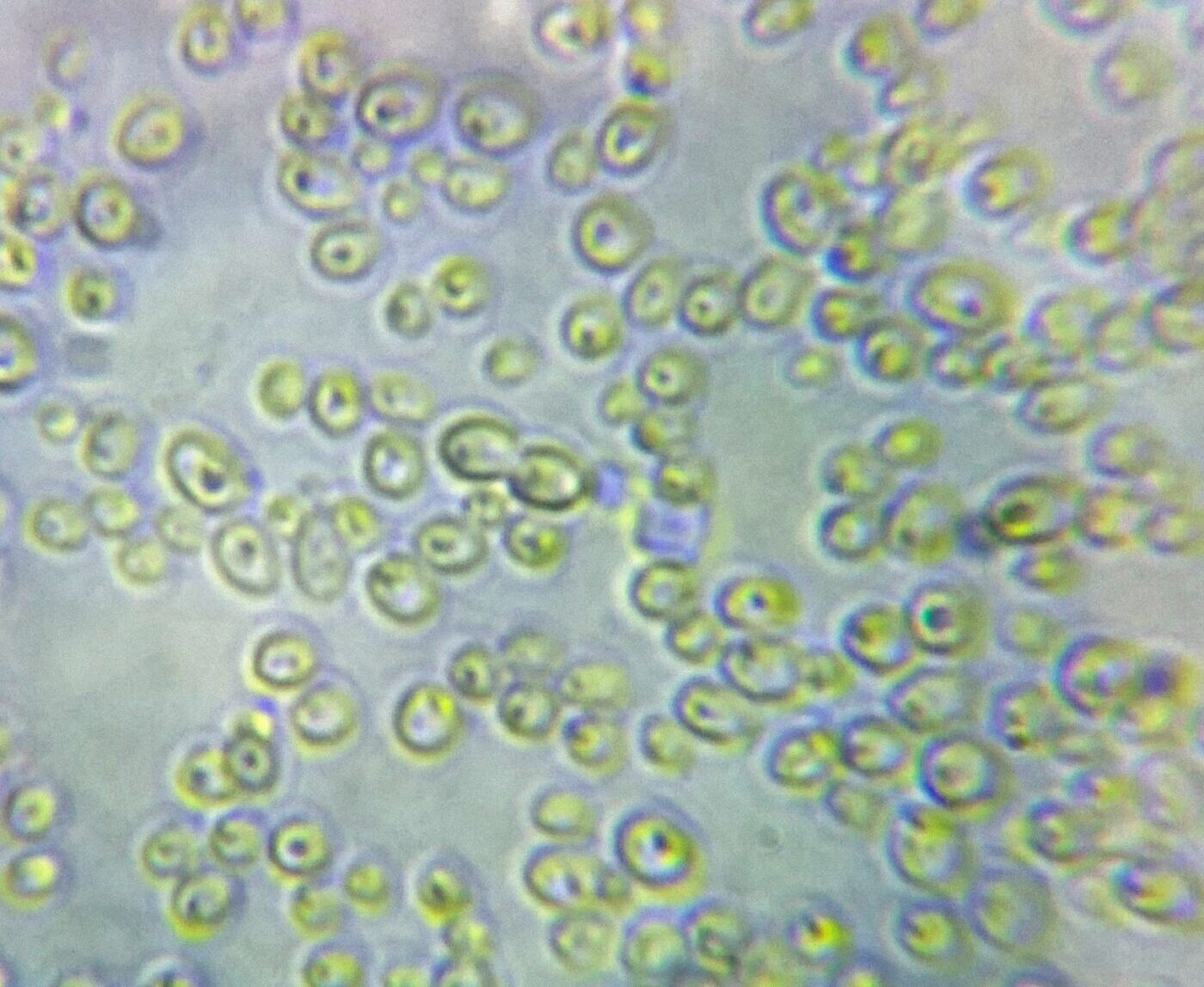 Candida albicans al microscopio