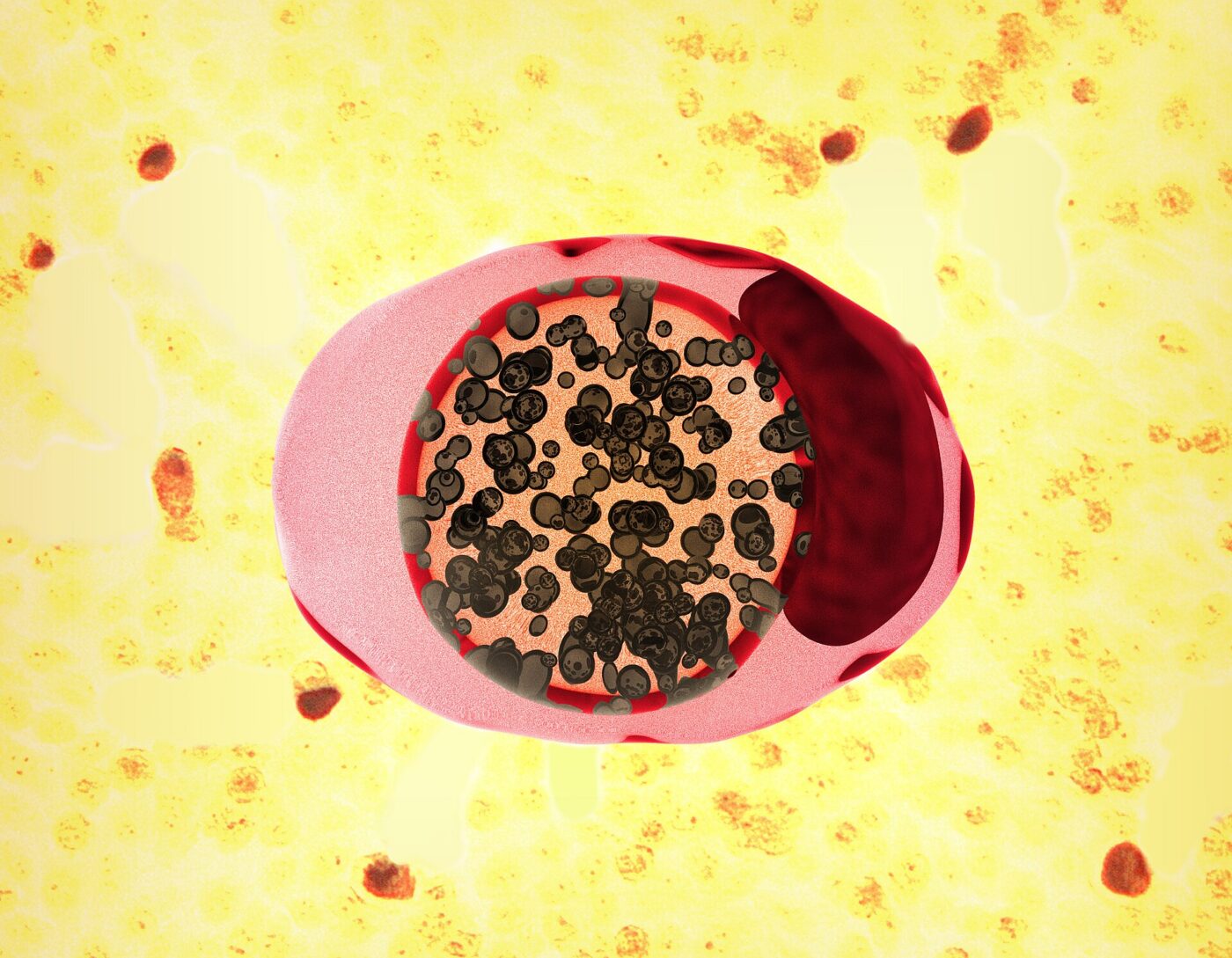 Chlamydia trachomatis al microscopio