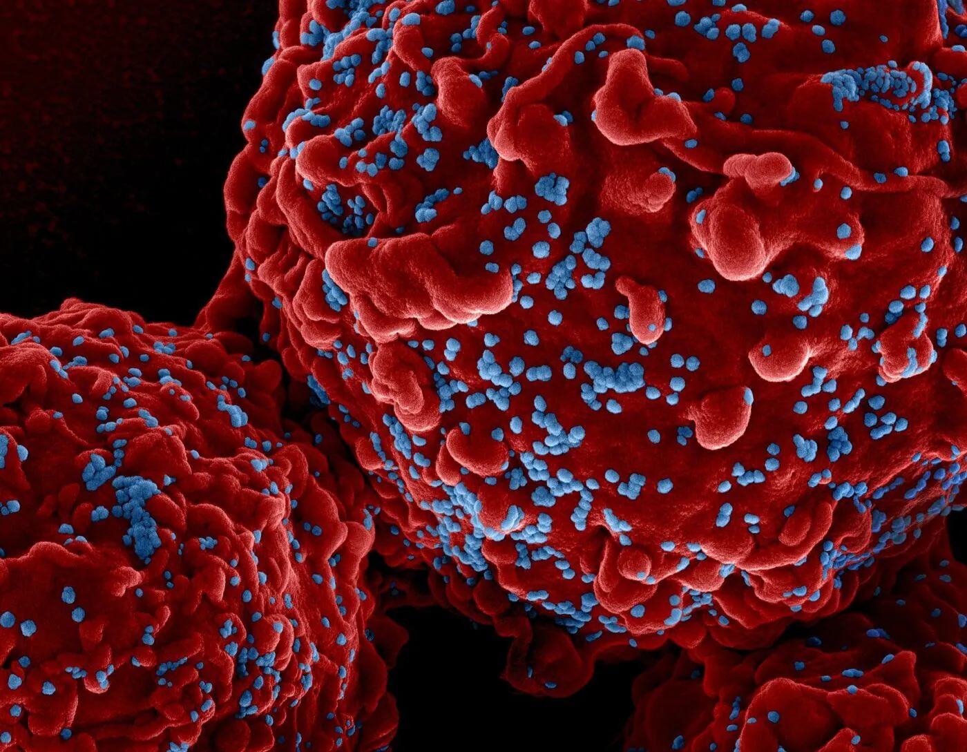Particelle di HIV al microscopio elettronico