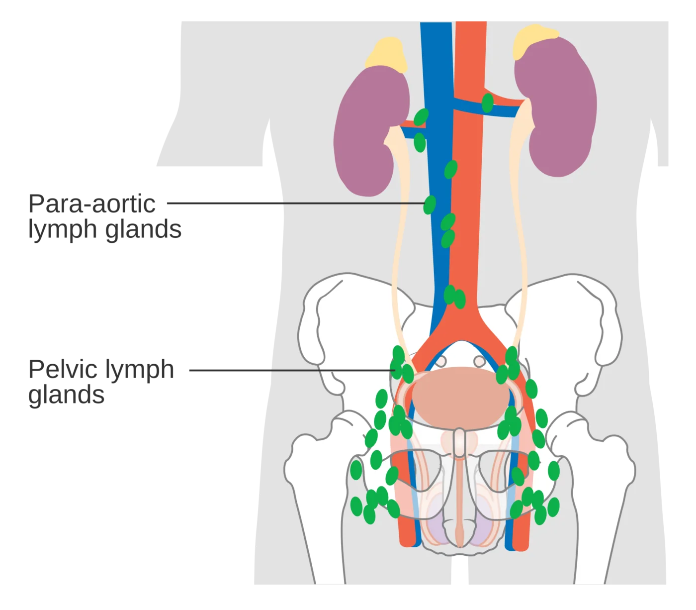 Linfonodi inguinali e pelvici