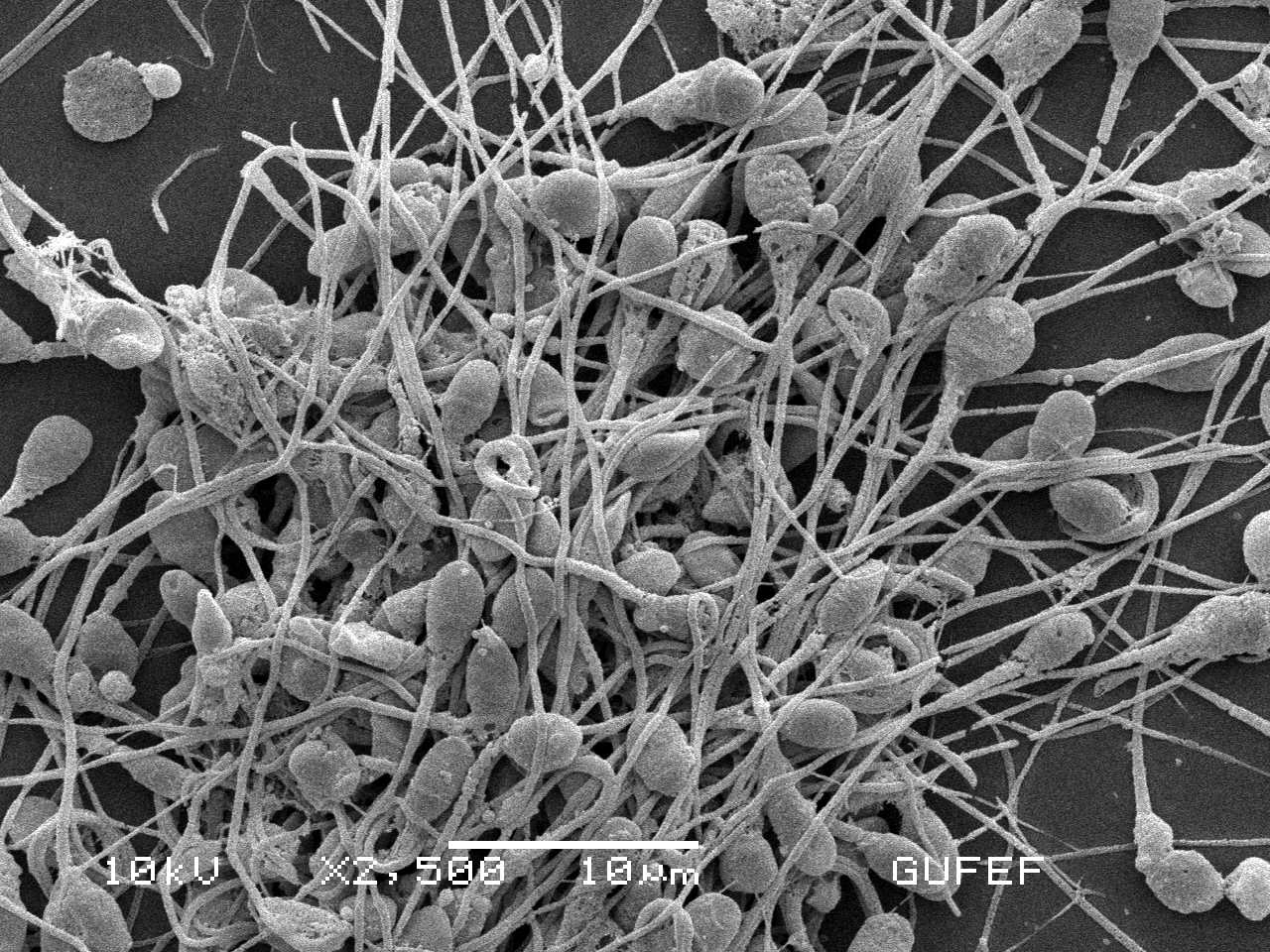 Spermatozoi al microscopio elettronico