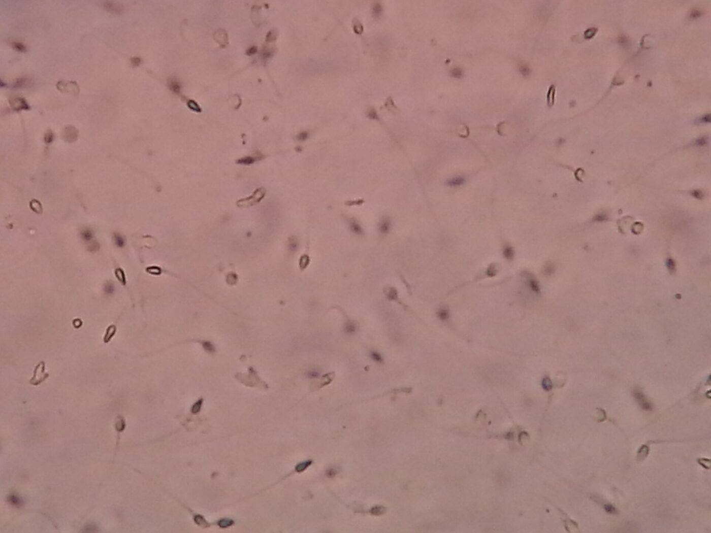 Spermatozoi osservati durante lo spermiogramma