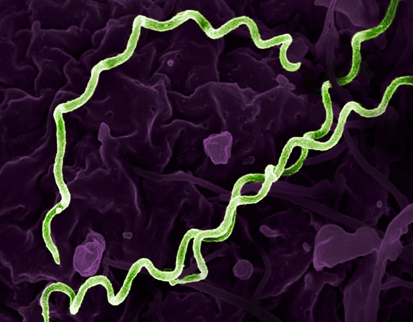 Treponema pallidum al microscopio